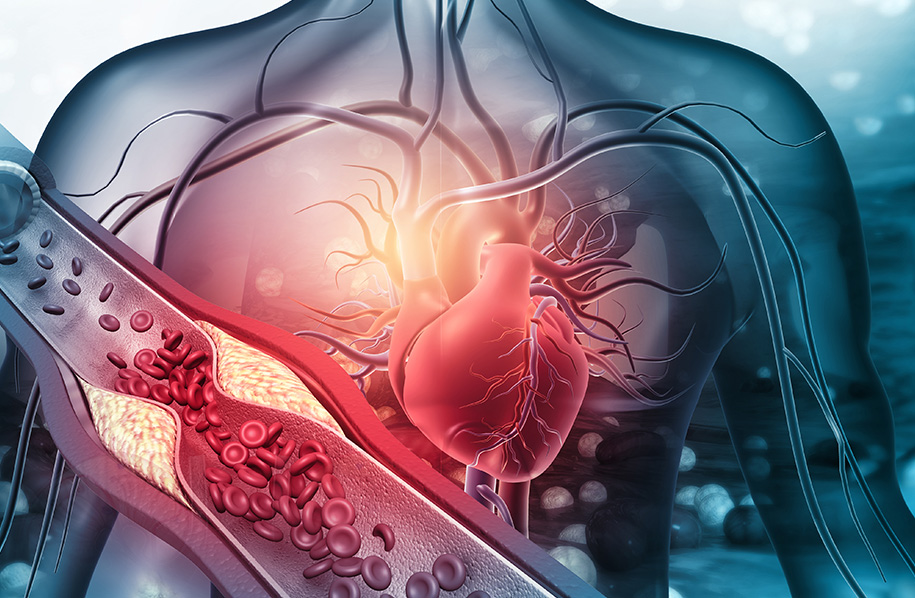 Risque cardiovasculaire