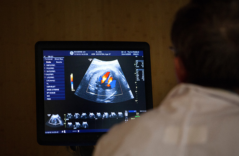 Consultation echodoppler